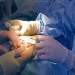 A New Hope for Arthroplasty Patients who Love to Practice a Sport