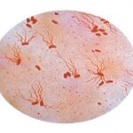 Imported Ahi Tuna Causes Salmonella Poisoning in 10 People