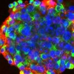 Stem Cell Research Promises Elusive Treatments